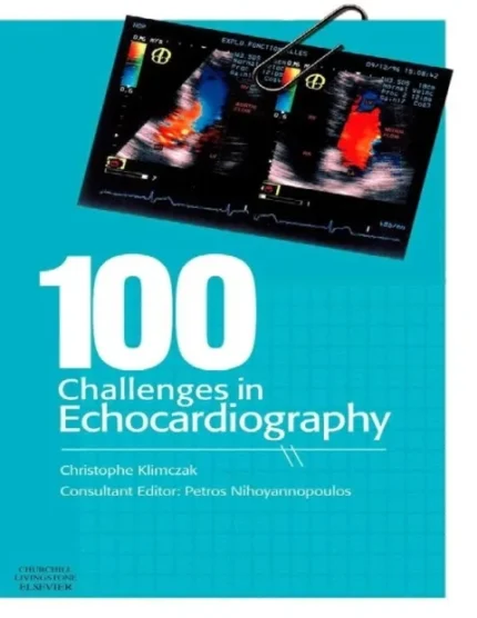 100 Challenges in Echocardiography