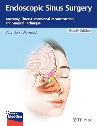 Endoscopic Sinus Surgery Fourth Edition