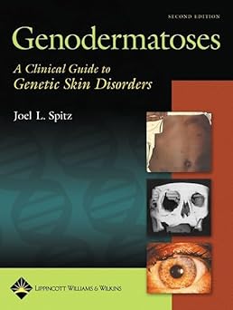 Genodermatoses: A Clinical Guide to Genetic Skin Disorders