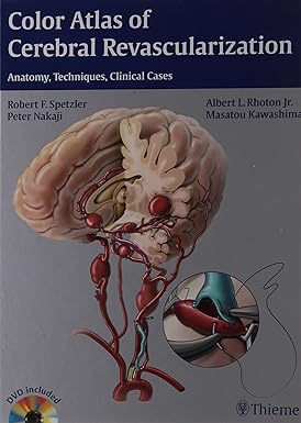 Color Atlas of Cerebral Revascularization