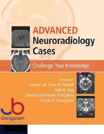 Advanced Neuroradiology Cases: Challenge Your Knowledge