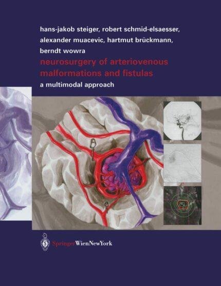 Neurosurgery of Arteriovenous Malformations and Fistulas: