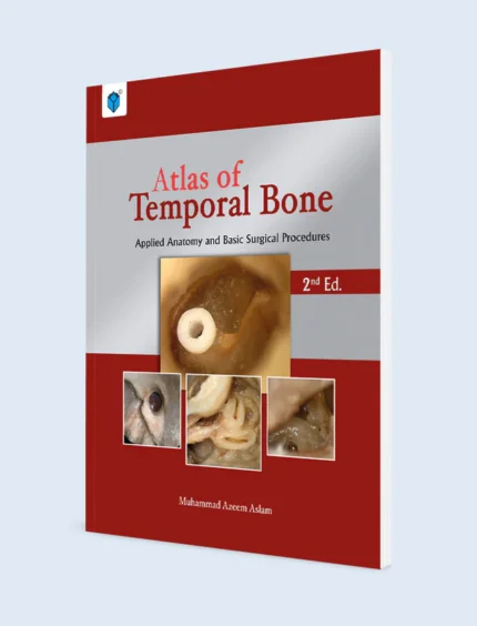 Atlas of Temporal Bone