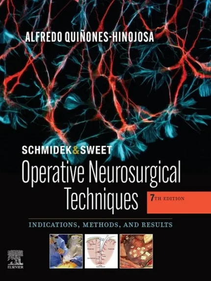 Schmidek and Sweet: Operative Neurosurgical Techniques